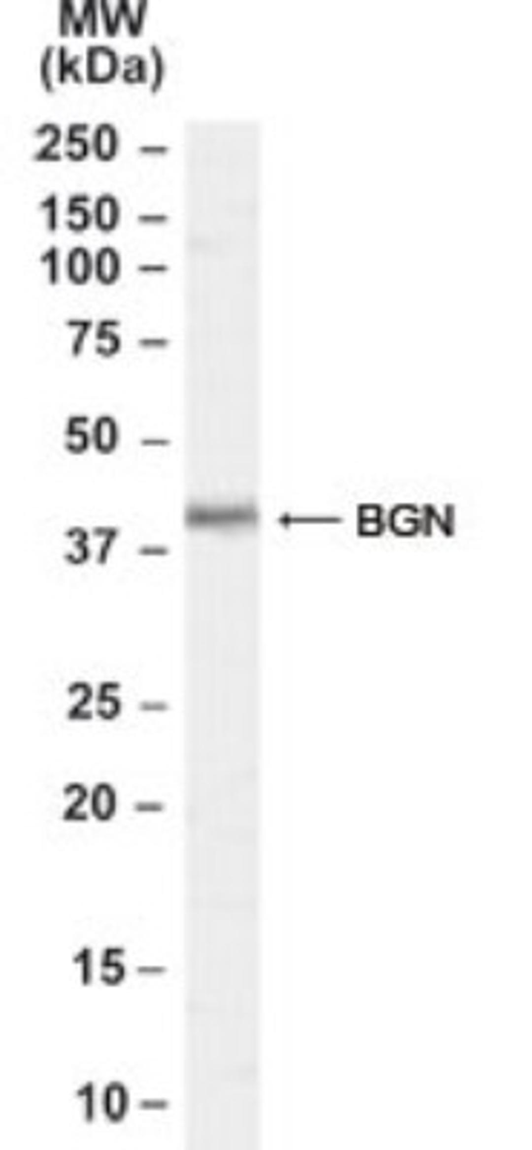 Western Blot: Biglycan Antibody [NB100-55407] - Analysis of Biglycan in Rat Skin lysate (35ug protein in RIPA buffer). Primary incubation was 1 hour.  Detected by chemiluminescence.