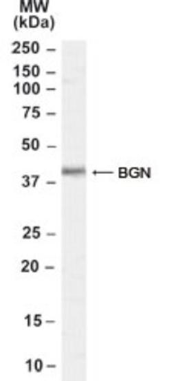 Western Blot: Biglycan Antibody [NB100-55407] - Analysis of Biglycan in Rat Skin lysate (35ug protein in RIPA buffer). Primary incubation was 1 hour.  Detected by chemiluminescence.