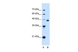 Antibody used in WB on Human HepG2 cells at 1.25 ug/ml.