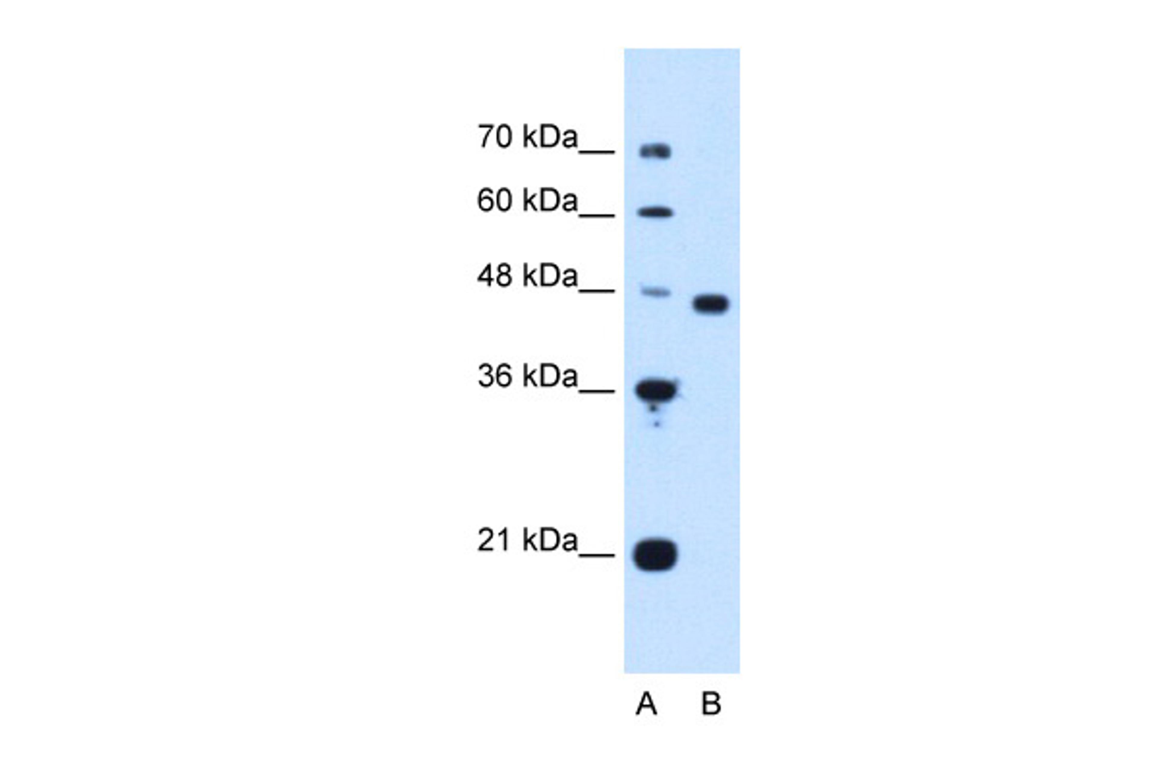 Antibody used in WB on Human HepG2 cells at 1.25 ug/ml.