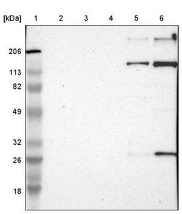 Western Blot: EMILIN1 Antibody [NBP1-84127] - Lane 1: Marker [kDa] 206, 113, 82, 49, 32, 26, 18<br/>Lane 2: Human cell line RT-4<br/>Lane 3: Human cell line U-251MG sp<br/>Lane 4: Human cell line A-431<br/>Lane 5: Human liver tissue<br/>Lane 6: Human tonsil tissue