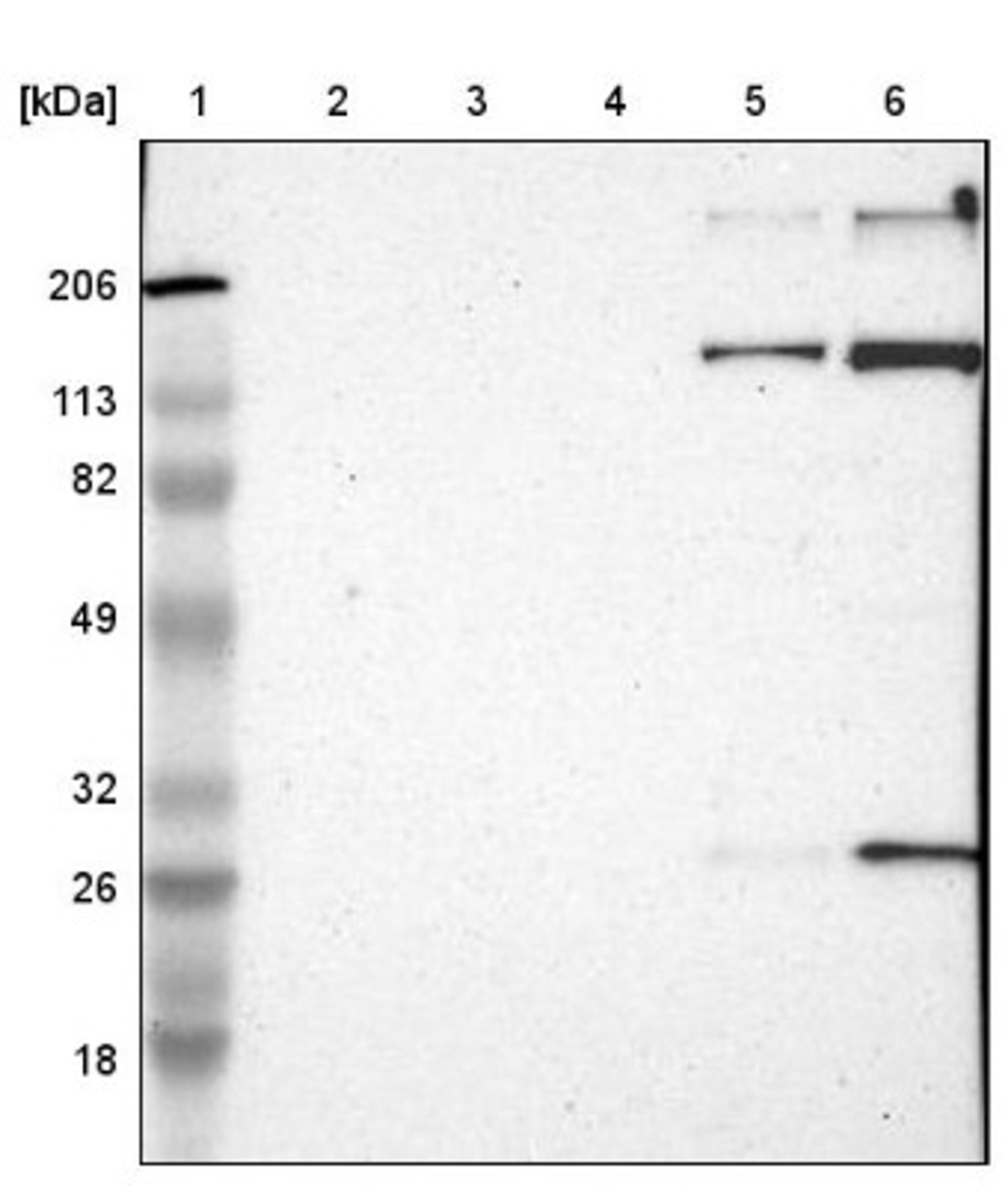 Western Blot: EMILIN1 Antibody [NBP1-84127] - Lane 1: Marker [kDa] 206, 113, 82, 49, 32, 26, 18<br/>Lane 2: Human cell line RT-4<br/>Lane 3: Human cell line U-251MG sp<br/>Lane 4: Human cell line A-431<br/>Lane 5: Human liver tissue<br/>Lane 6: Human tonsil tissue