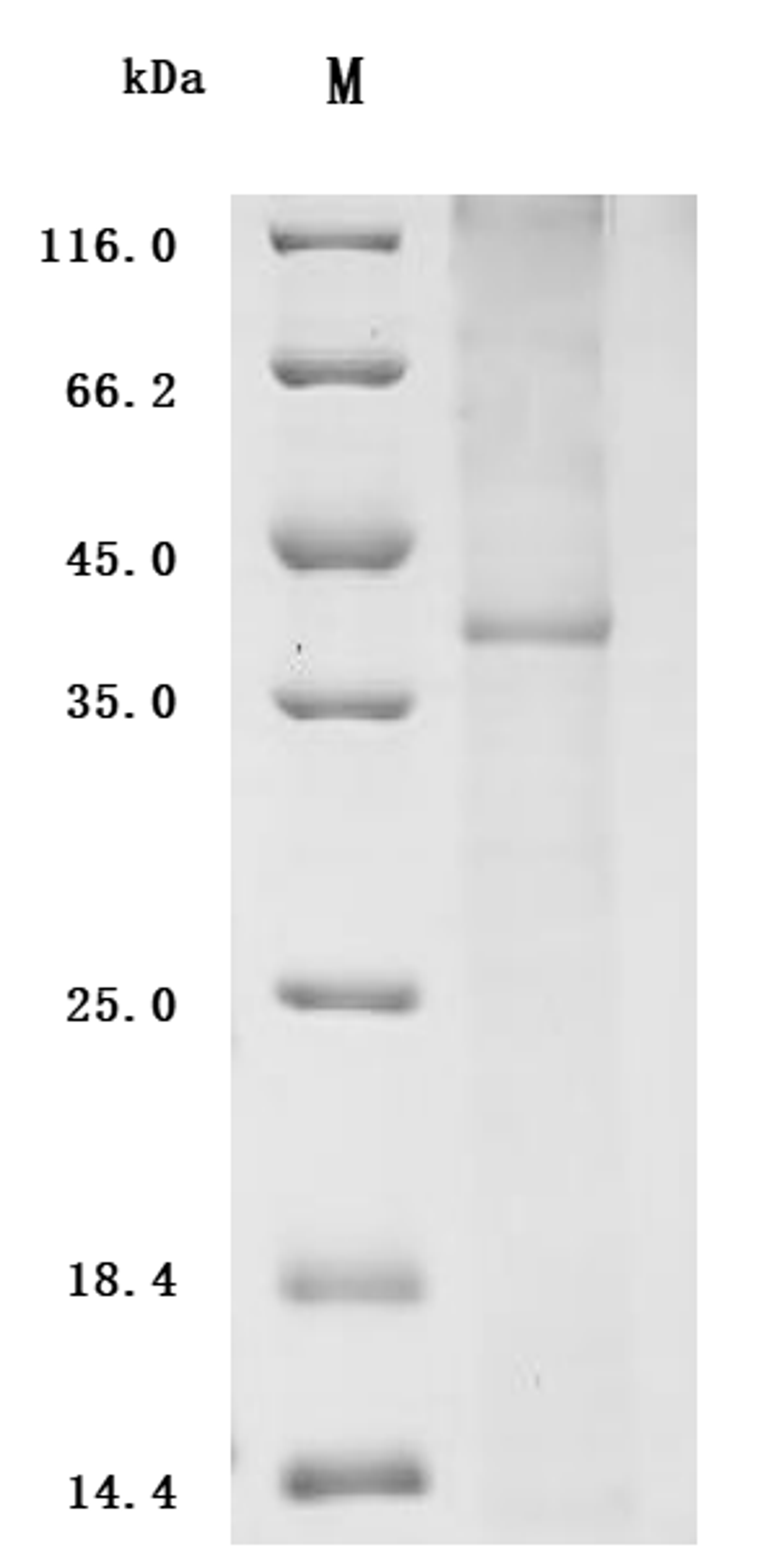 (Tris-Glycine gel) Discontinuous SDS-PAGE (reduced) with 5% enrichment gel and 15% separation gel.