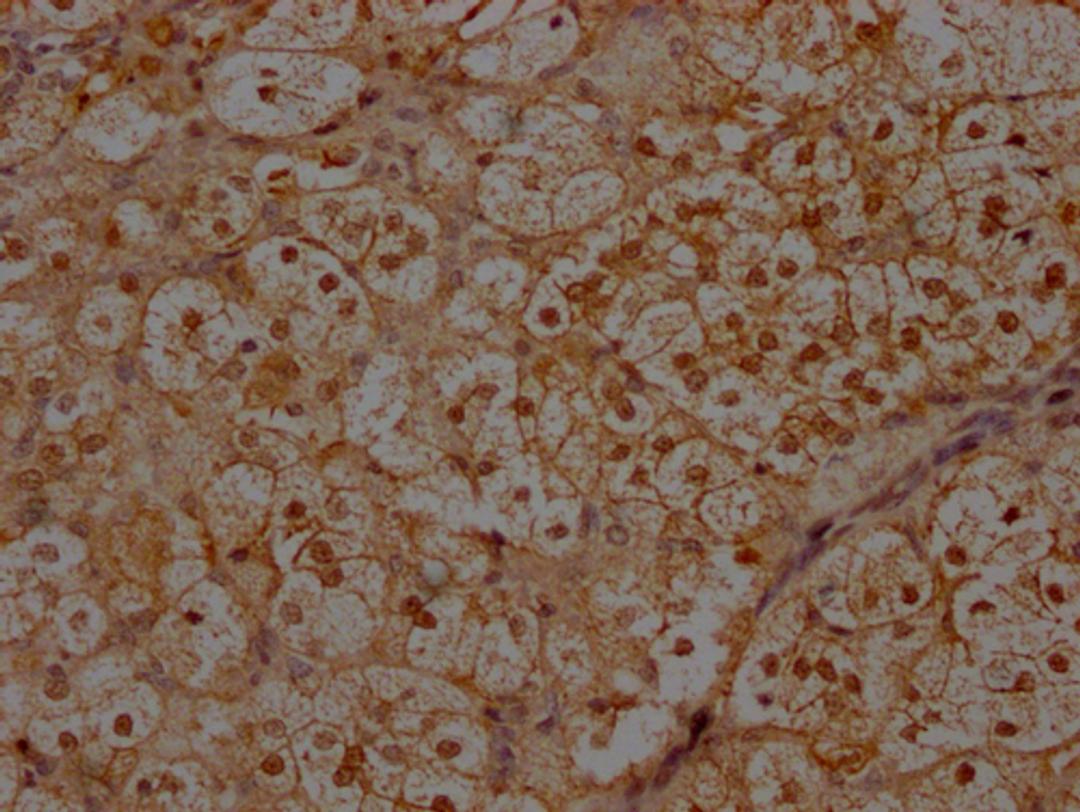 IHC image of CSB-PA011758LA01HU diluted at 1:300 and staining in paraffin-embedded human adrenal gland tissue performed on a Leica BondTM system. After dewaxing and hydration, antigen retrieval was mediated by high pressure in a citrate buffer (pH 6.0). Section was blocked with 10% normal goat serum 30min at RT. Then primary antibody (1% BSA) was incubated at 4°C overnight. The primary is detected by a Goat anti-rabbit polymer IgG labeled by HRP and visualized using 0.05% DAB.