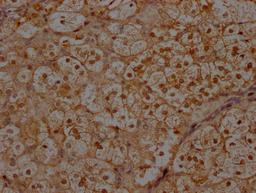 IHC image of CSB-PA011758LA01HU diluted at 1:300 and staining in paraffin-embedded human adrenal gland tissue performed on a Leica BondTM system. After dewaxing and hydration, antigen retrieval was mediated by high pressure in a citrate buffer (pH 6.0). Section was blocked with 10% normal goat serum 30min at RT. Then primary antibody (1% BSA) was incubated at 4°C overnight. The primary is detected by a Goat anti-rabbit polymer IgG labeled by HRP and visualized using 0.05% DAB.