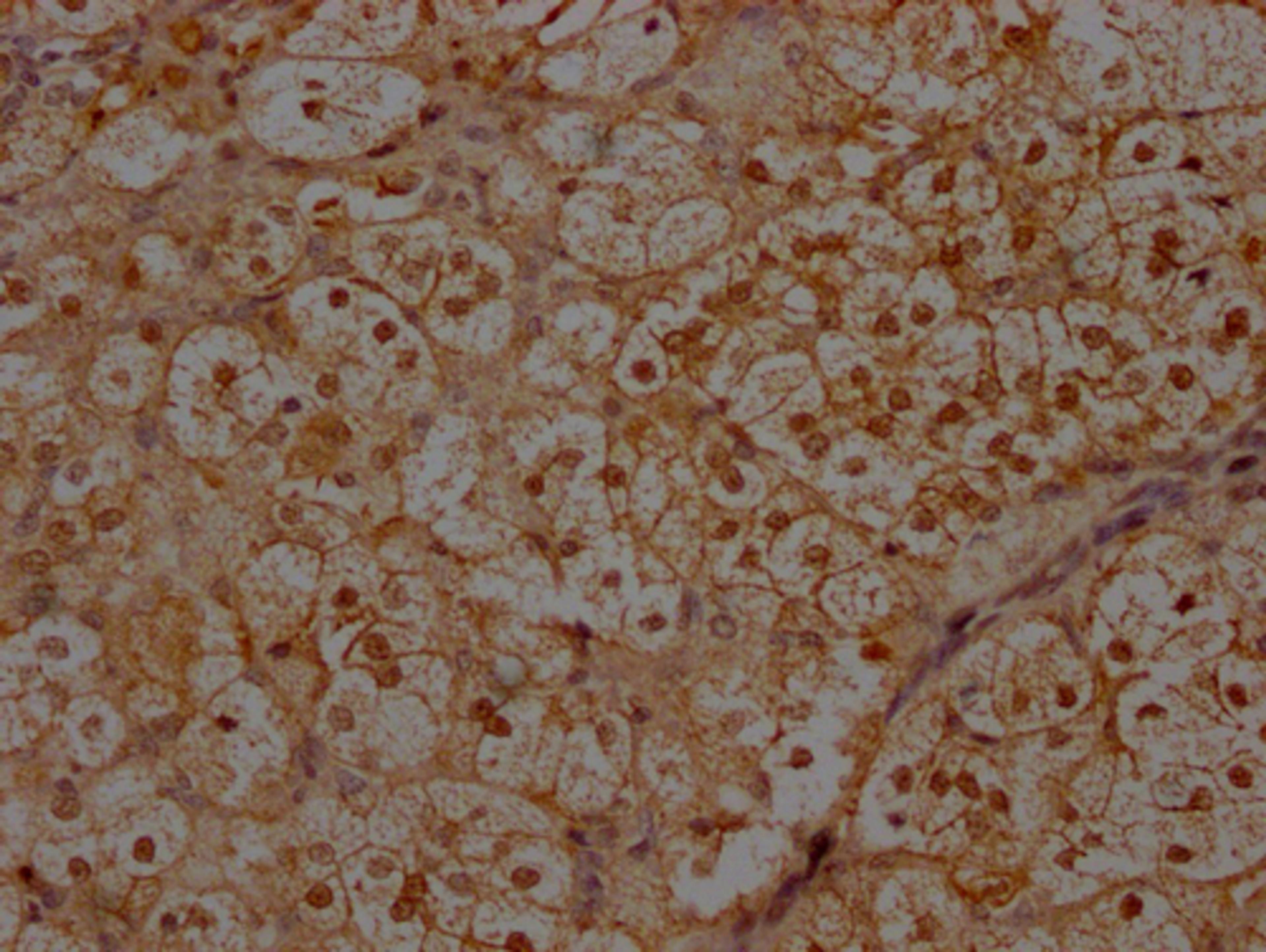 IHC image of CSB-PA011758LA01HU diluted at 1:300 and staining in paraffin-embedded human adrenal gland tissue performed on a Leica BondTM system. After dewaxing and hydration, antigen retrieval was mediated by high pressure in a citrate buffer (pH 6.0). Section was blocked with 10% normal goat serum 30min at RT. Then primary antibody (1% BSA) was incubated at 4°C overnight. The primary is detected by a Goat anti-rabbit polymer IgG labeled by HRP and visualized using 0.05% DAB.