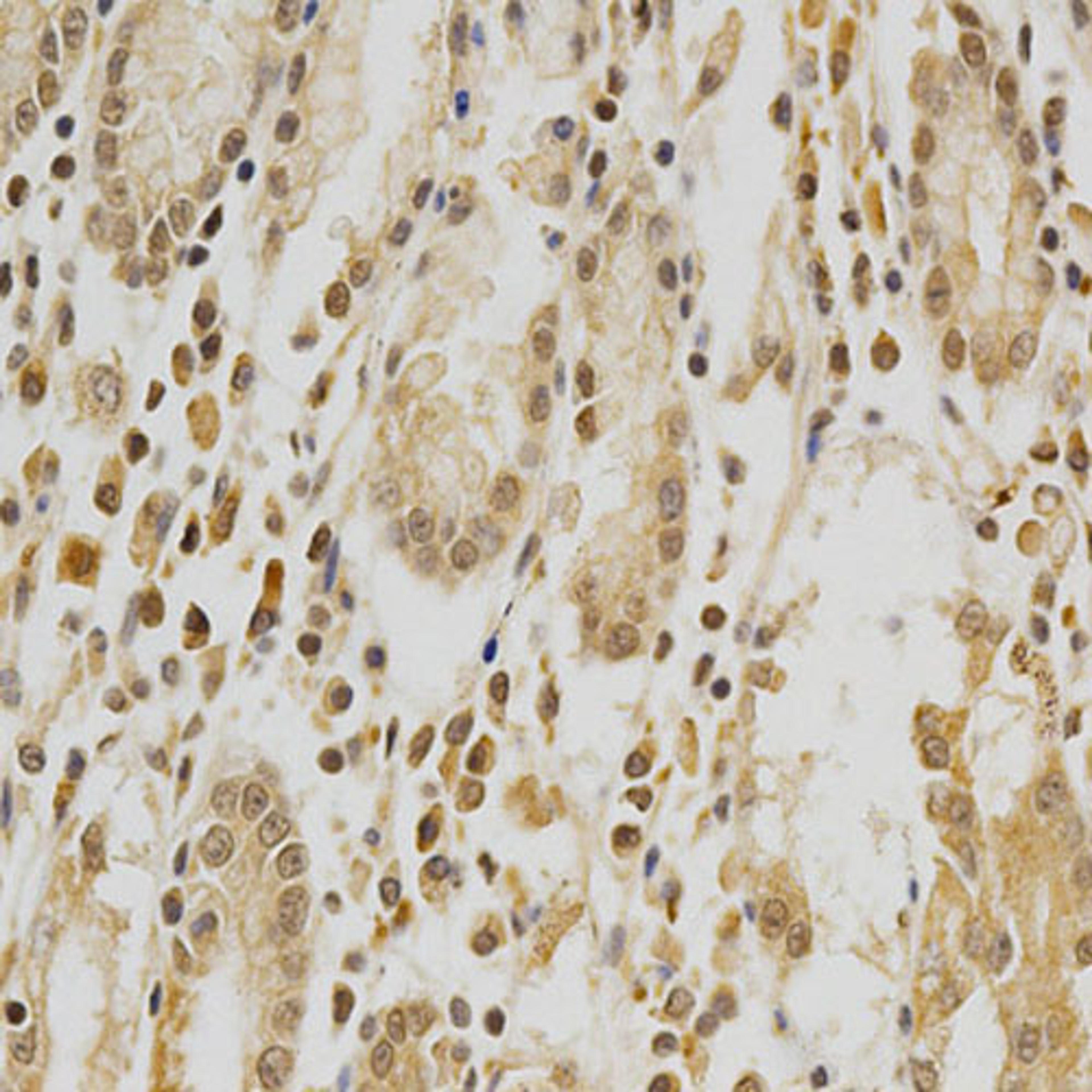 Immunohistochemistry  - HDAC6 antibody (A11429)