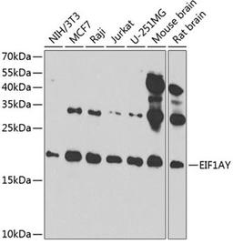 Western blot - EIF1AY antibody (A4270)