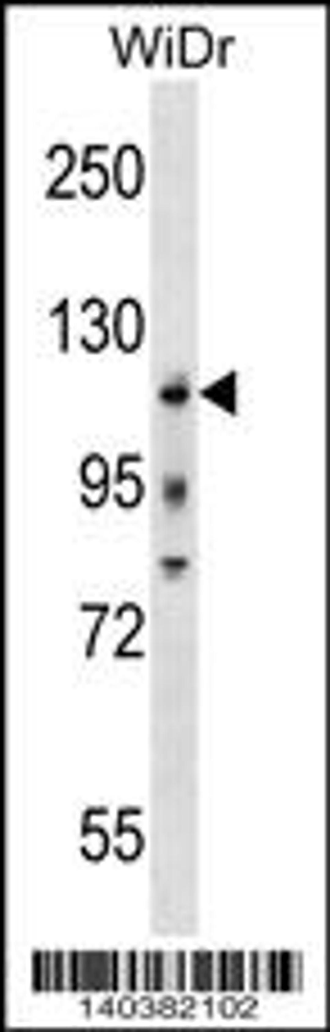 Western blot analysis in WiDr cell line lysates (35ug/lane).This demonstrates the KIT antibody detected the KIT protein (arrow).