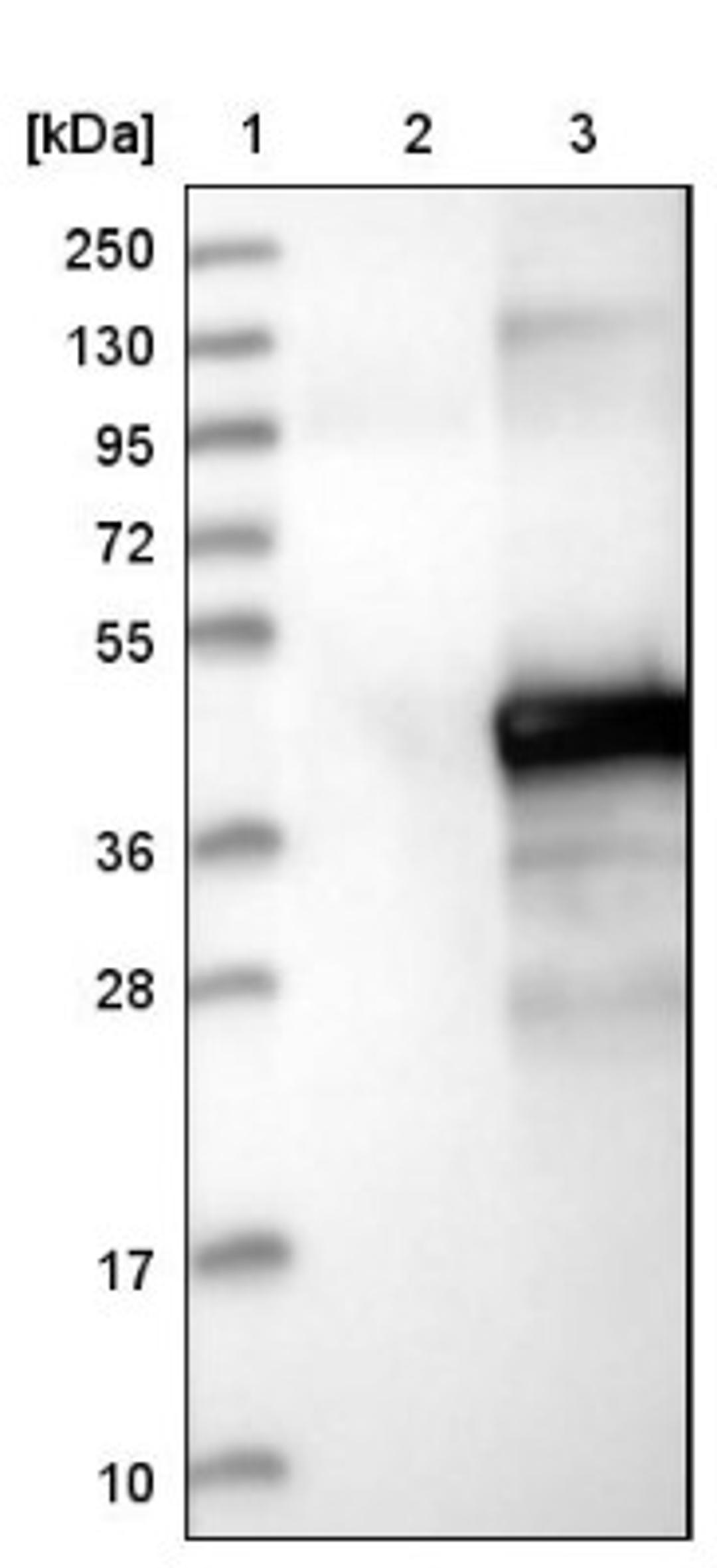 Western Blot: ETV7 Antibody [NBP1-80694] - Lane 1: Marker [kDa] 250, 130, 95, 72, 55, 36, 28, 17, 10<br/>Lane 2: Negative control (vector only transfected HEK293T lysate)<br/>Lane 3: Over-expression lysate (Co-expressed with a C-terminal myc-DDK tag (~3.1 kDa) in mammalian HEK293T cells, LY414164)