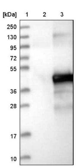 Western Blot: ETV7 Antibody [NBP1-80694] - Lane 1: Marker [kDa] 250, 130, 95, 72, 55, 36, 28, 17, 10<br/>Lane 2: Negative control (vector only transfected HEK293T lysate)<br/>Lane 3: Over-expression lysate (Co-expressed with a C-terminal myc-DDK tag (~3.1 kDa) in mammalian HEK293T cells, LY414164)