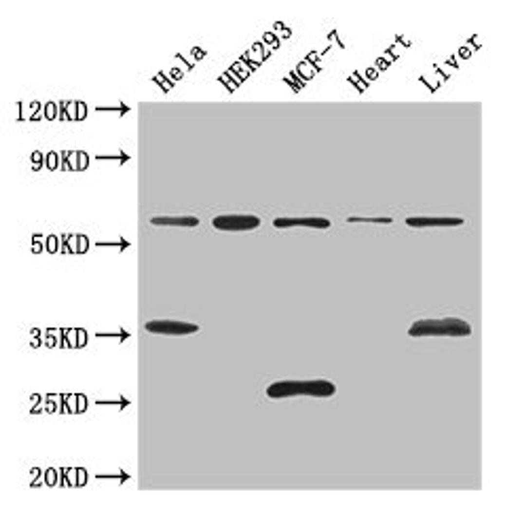 Western Blot. Positive WB detected in: Hela whole cell lysate, HEK293 whole cell lysate, MCF-7 whole cell lysate, Mouse heart tissue, Mouse liver tissue. All lanes: NCOA5 antibody at 3ug/ml. Secondary. Goat polyclonal to rabbit IgG at 1/50000 dilution. Predicted band size: 66 kDa. Observed band size: 66, 35, 25 kDa. 
