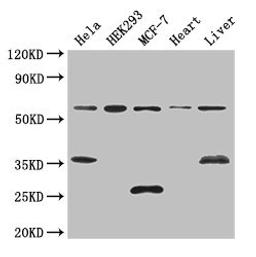 Western Blot. Positive WB detected in: Hela whole cell lysate, HEK293 whole cell lysate, MCF-7 whole cell lysate, Mouse heart tissue, Mouse liver tissue. All lanes: NCOA5 antibody at 3ug/ml. Secondary. Goat polyclonal to rabbit IgG at 1/50000 dilution. Predicted band size: 66 kDa. Observed band size: 66, 35, 25 kDa. 