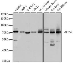 Western blot - ACSS2 antibody (A6472)