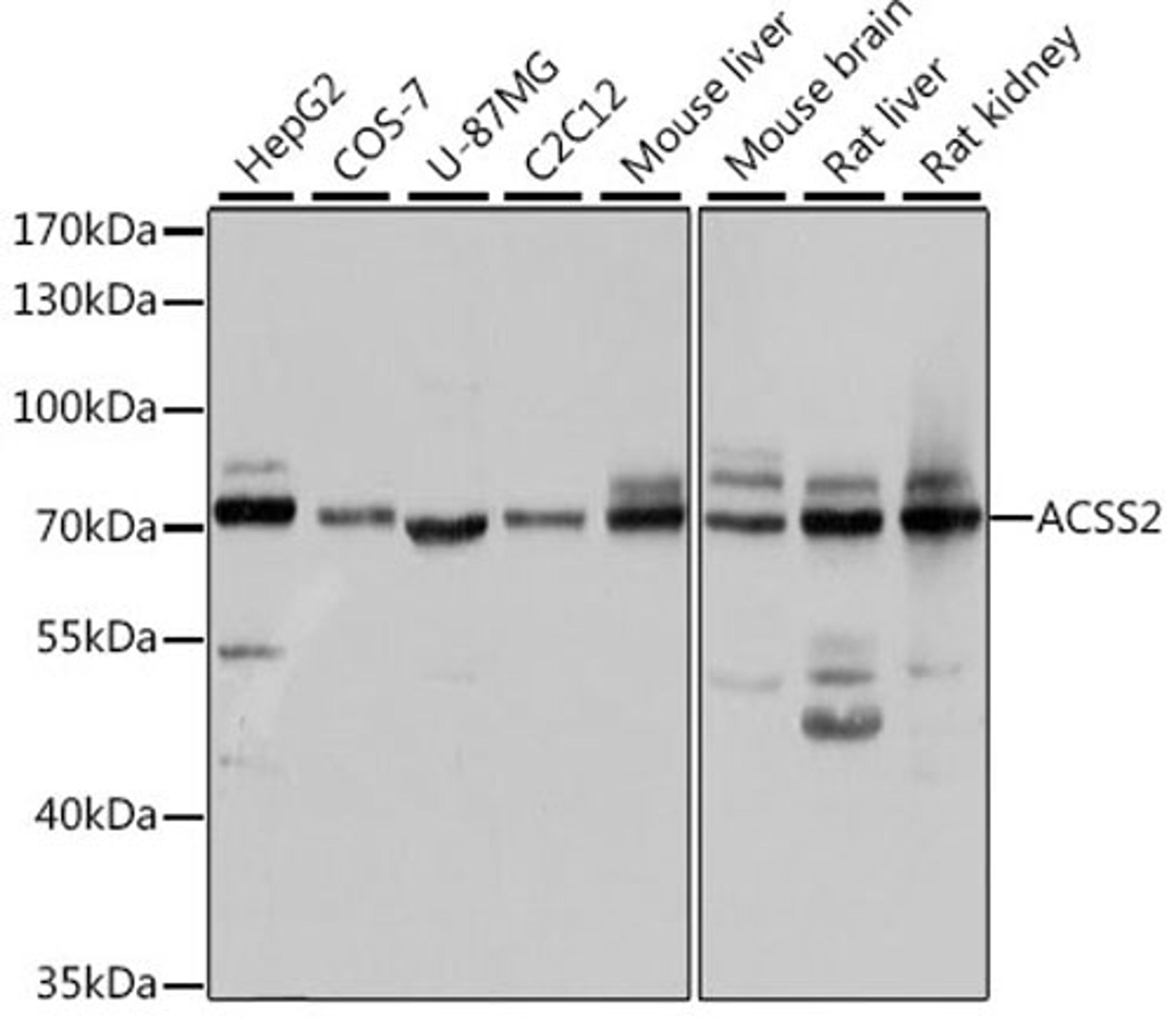 Western blot - ACSS2 antibody (A6472)