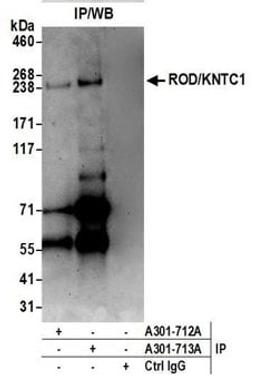 Detection of human ROD/KNTC1 by western blot of immunoprecipitates.