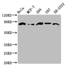 Western Blot. Positive WB detected in: Hela whole cell lysate, MCF-7 whole cell lysate, 293 whole cell lysate, U87 whole cell lysate, SH-SY5Y whole cell lysate.  All lanes: BARD1 antibody at 3.6ug/ml. Secondary. Goat polyclonal to rabbit IgG at 1/50000 dilution. Predicted band size: 87, 85, 76, 15 kDa. Observed band size: 87 kDa.