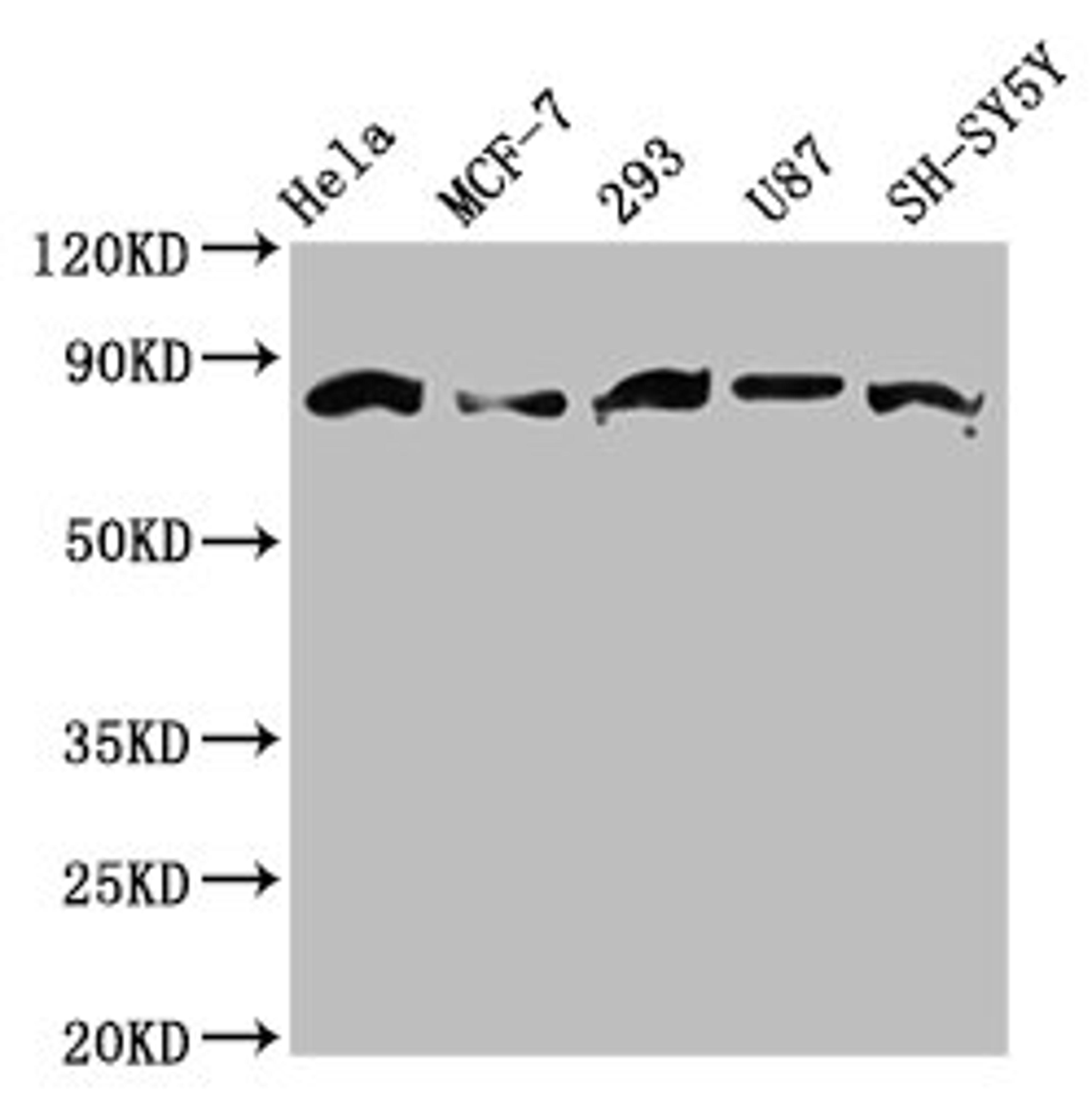 Western Blot. Positive WB detected in: Hela whole cell lysate, MCF-7 whole cell lysate, 293 whole cell lysate, U87 whole cell lysate, SH-SY5Y whole cell lysate.  All lanes: BARD1 antibody at 3.6ug/ml. Secondary. Goat polyclonal to rabbit IgG at 1/50000 dilution. Predicted band size: 87, 85, 76, 15 kDa. Observed band size: 87 kDa.