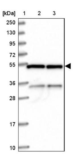 Western Blot: C20orf72 Antibody [NBP1-91726] - Lane 1: Marker [kDa] 250, 130, 95, 72, 55, 36, 28, 17, 10<br/>Lane 2: Human cell line RT-4<br/>Lane 3: Human cell line U-251MG sp