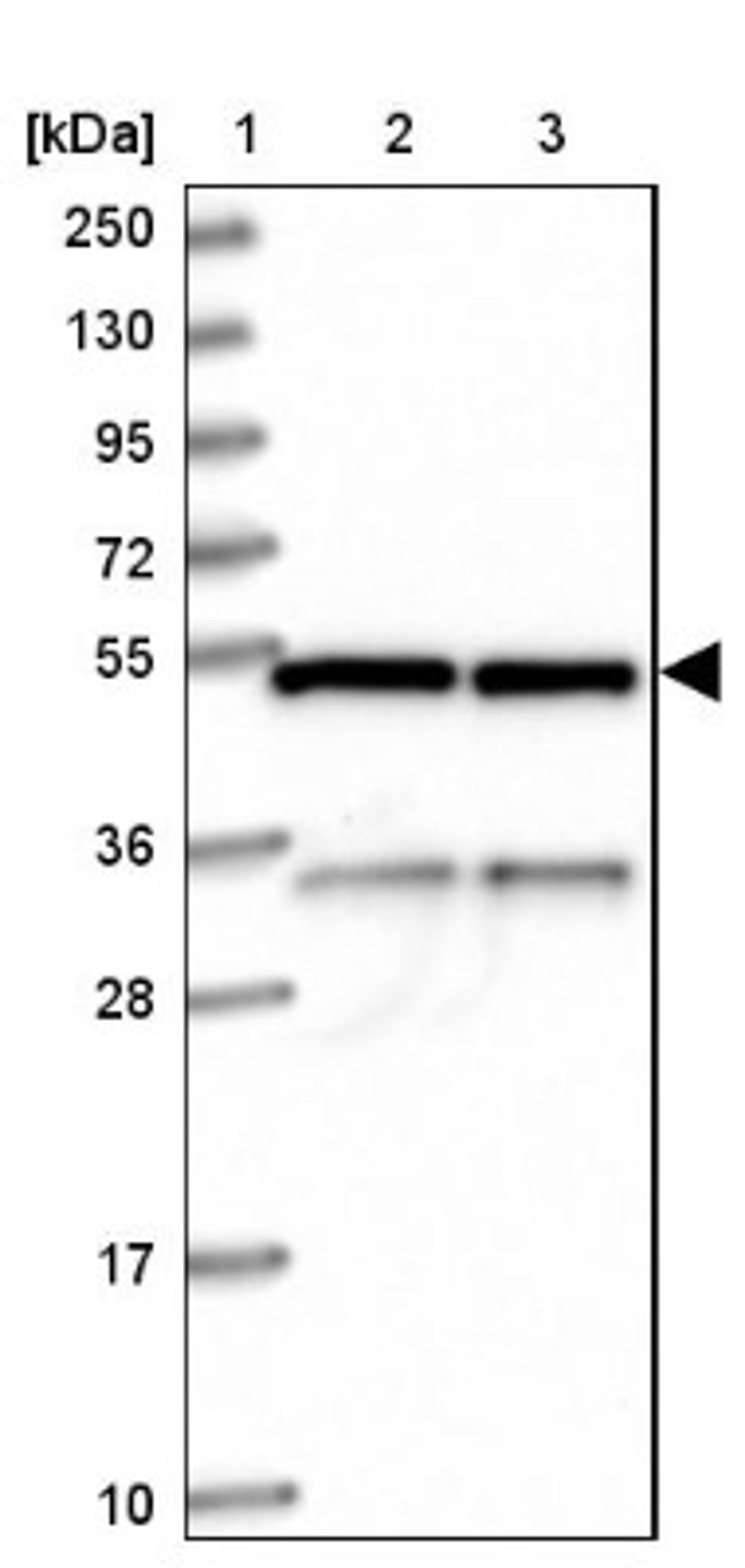 Western Blot: C20orf72 Antibody [NBP1-91726] - Lane 1: Marker [kDa] 250, 130, 95, 72, 55, 36, 28, 17, 10<br/>Lane 2: Human cell line RT-4<br/>Lane 3: Human cell line U-251MG sp