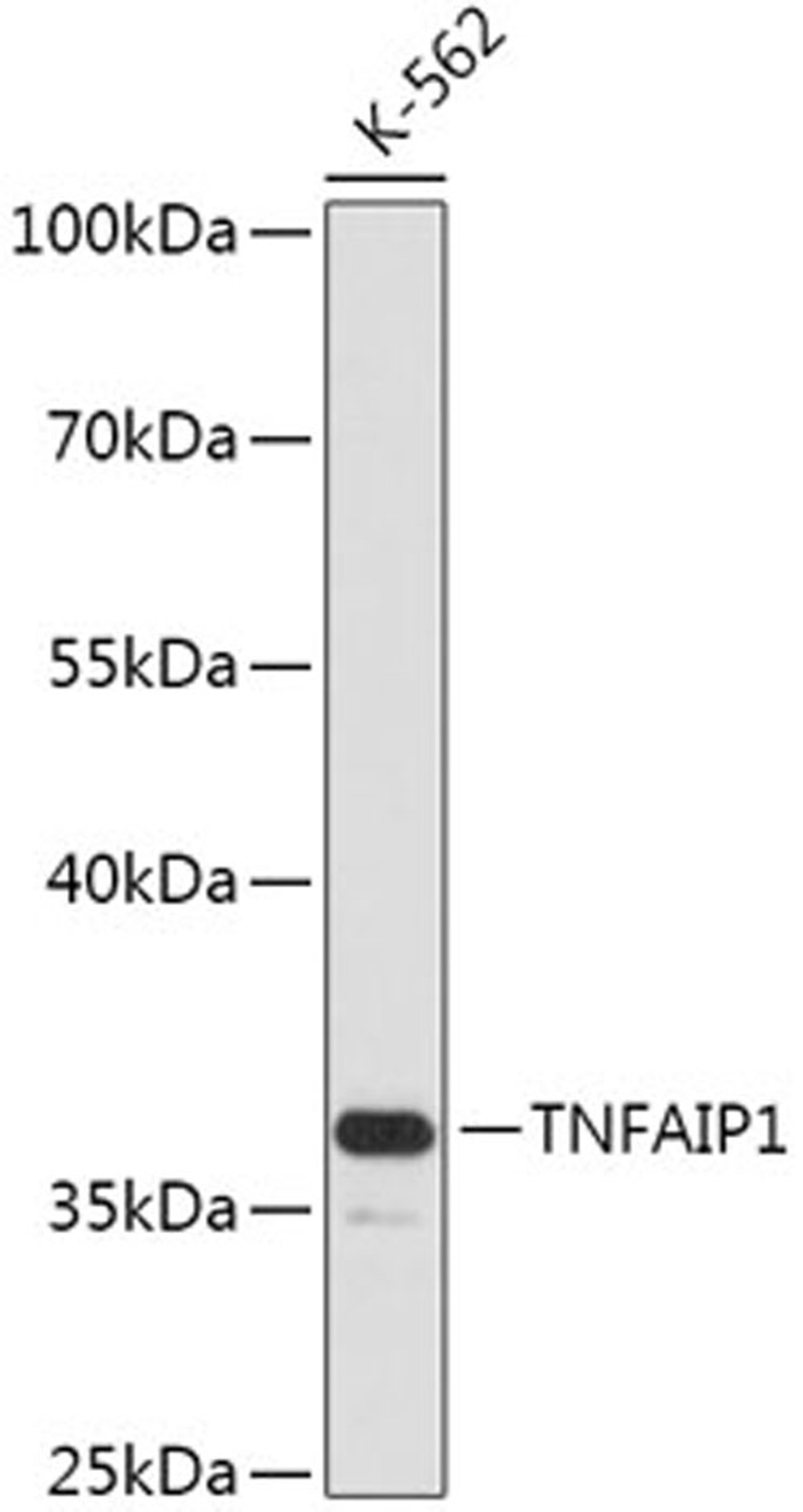 Western blot - TNFAIP1 antibody (A17543)