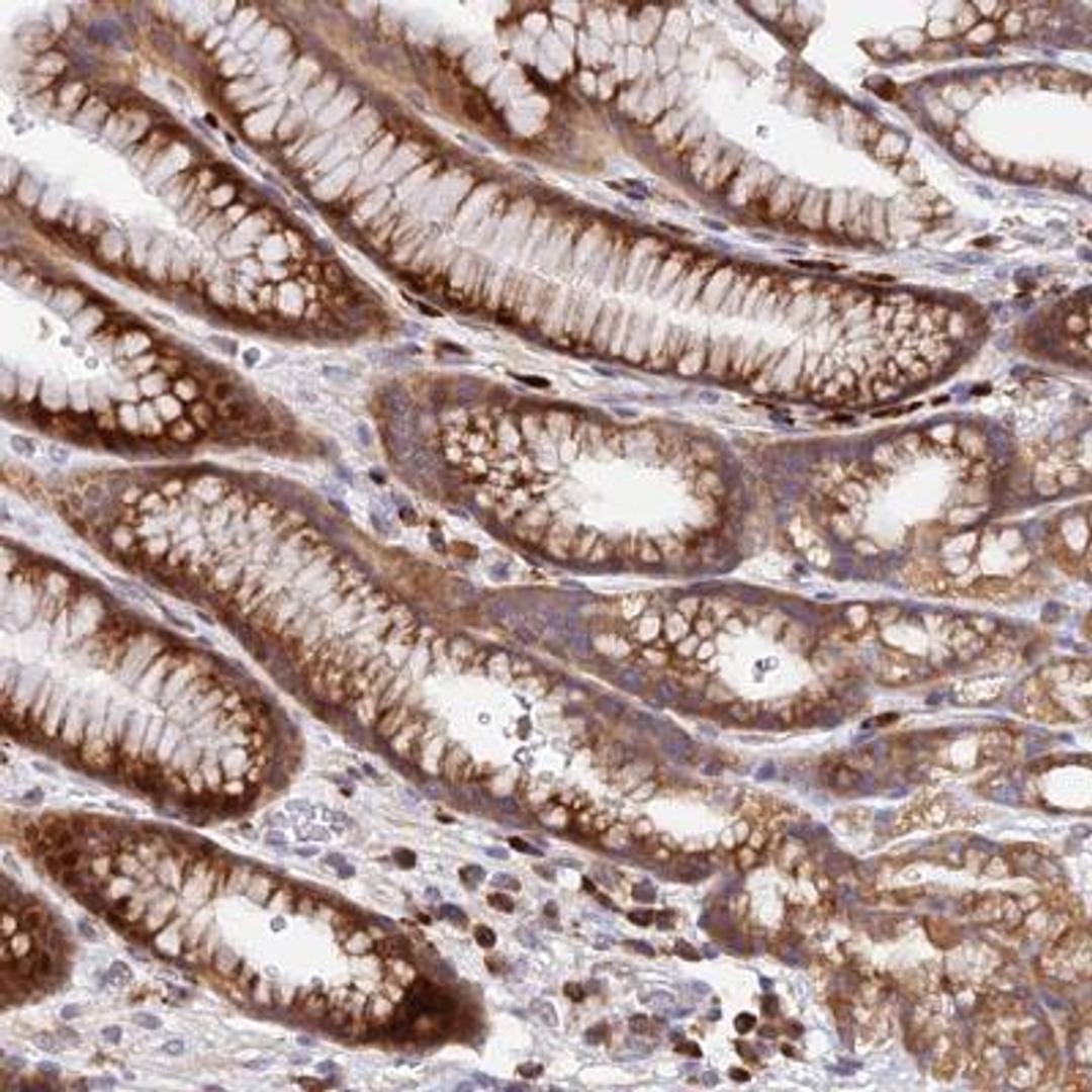 Immunohistochemistry: CCT6A Antibody [NBP2-46686] - Analysis  of human stomach, lower shows strong cytoplasmic positivity in glandular cells.