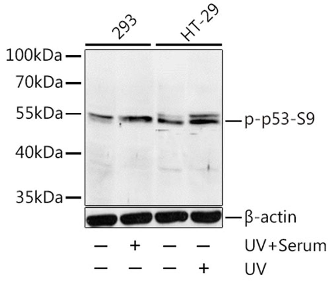 Western blot - Phospho-p53-S9 antibody (AP0085)