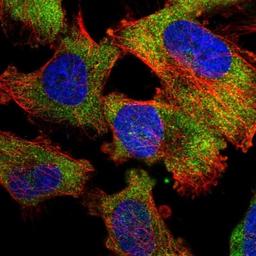 Immunocytochemistry/Immunofluorescence: RBP7 Antibody [NBP1-84383] - Staining of human cell line U-251 MG shows positivity in cytoplasm.