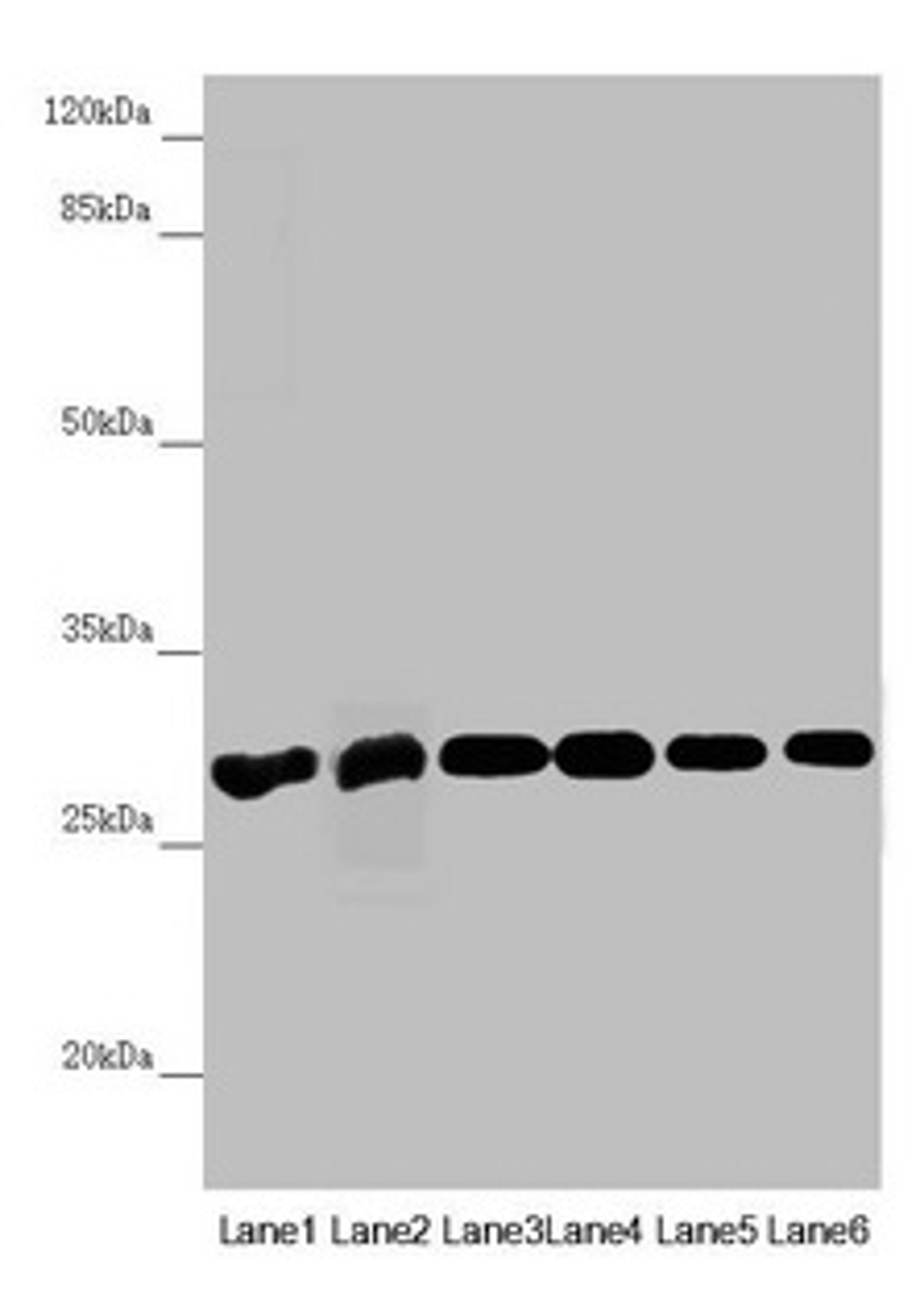 Western blot. All lanes: PGLS antibody at 3.94µg/ml. Lane 1: Mouse liver tissue. Lane 2: Mouse brain tissue. Lane 3: U251 whole cell lysate. Lane 4: THP-1 whole cell lysate. Lane 5: HepG2 whole cell lysate. Lane 6: Hela whole cell lysate. Secondary. Goat polyclonal to rabbit IgG at 1/10000 dilution. Predicted band size: 28 kDa. Observed band size: 28 kDa