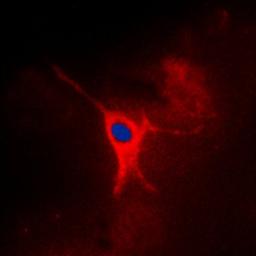 Immunofluorescense analysis of MCF7 cells using AMPK gamma 2 antibody