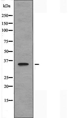 Western blot analysis of HeLa cells, COLO cells and MCF-7cells using OR10G4 antibody