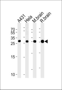 Western blot analysis in A431,Hela cell line,mouse brain and rat brain lysates (35ug/lane).