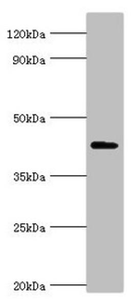 Western blot. All lanes: Aryl-hydrocarbon-interacting protein-like 1 antibody at 5ug/ml + Rat brain tissue. Secondary. Goat polyclonal to rabbit IgG at 1/10000 dilution. Predicted band size: 44, 37, 42, 41 kDa. Observed band size: 44 kDa. 
