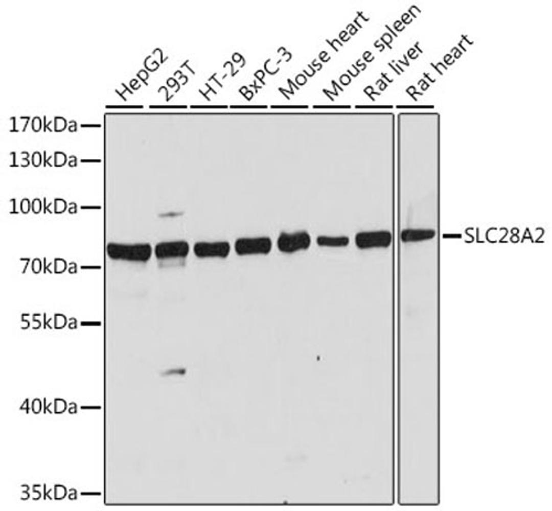 Western blot - SLC28A2 antibody (A16086)