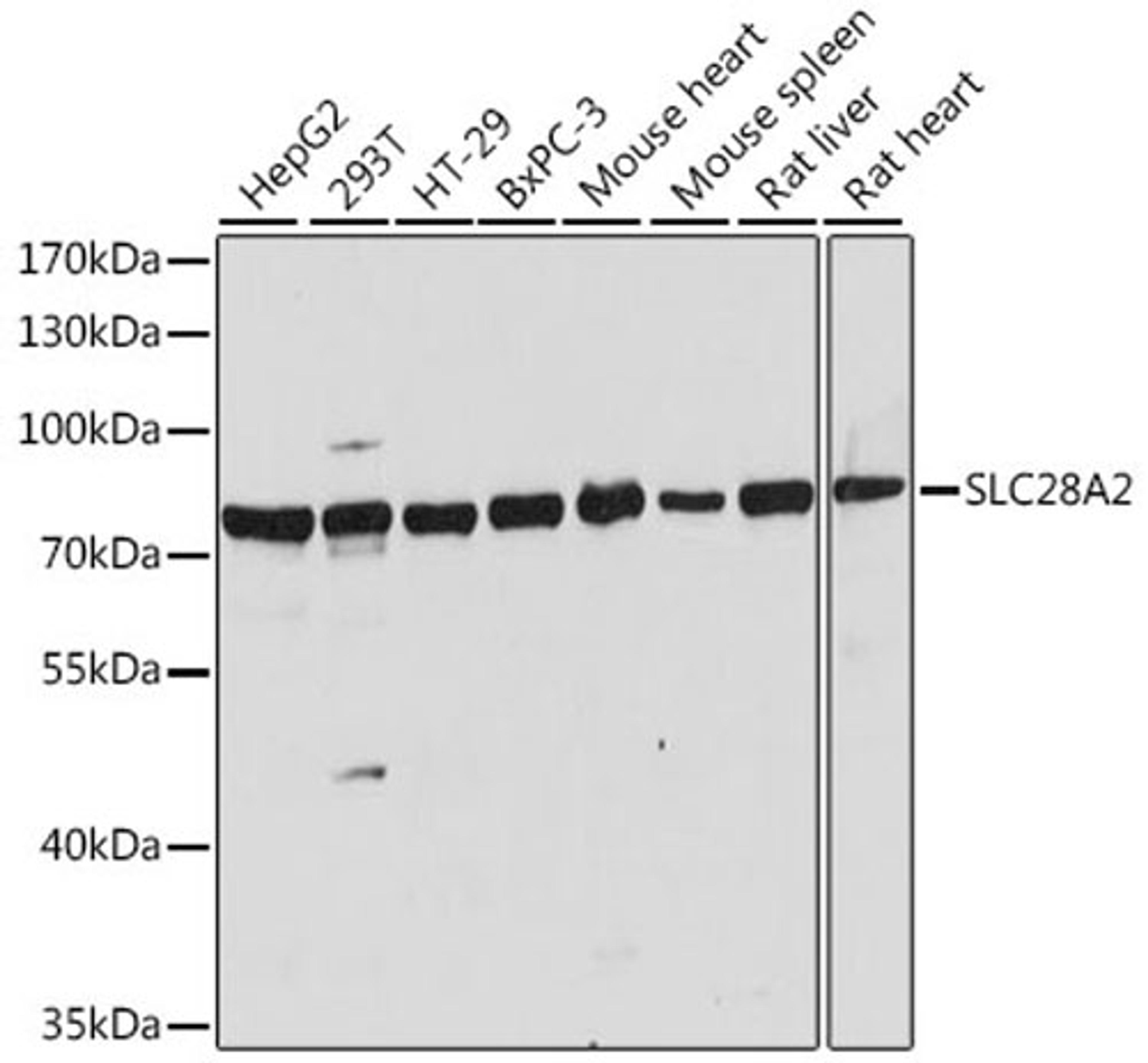 Western blot - SLC28A2 antibody (A16086)