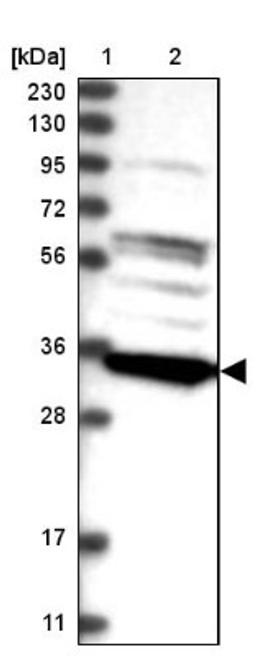 Western Blot: C8orf41/TTI2 Antibody [NBP1-82085] - Lane 1: Marker [kDa] 230, 130, 95, 72, 56, 36, 28, 17, 11<br/>Lane 2: Human cell line RT-4