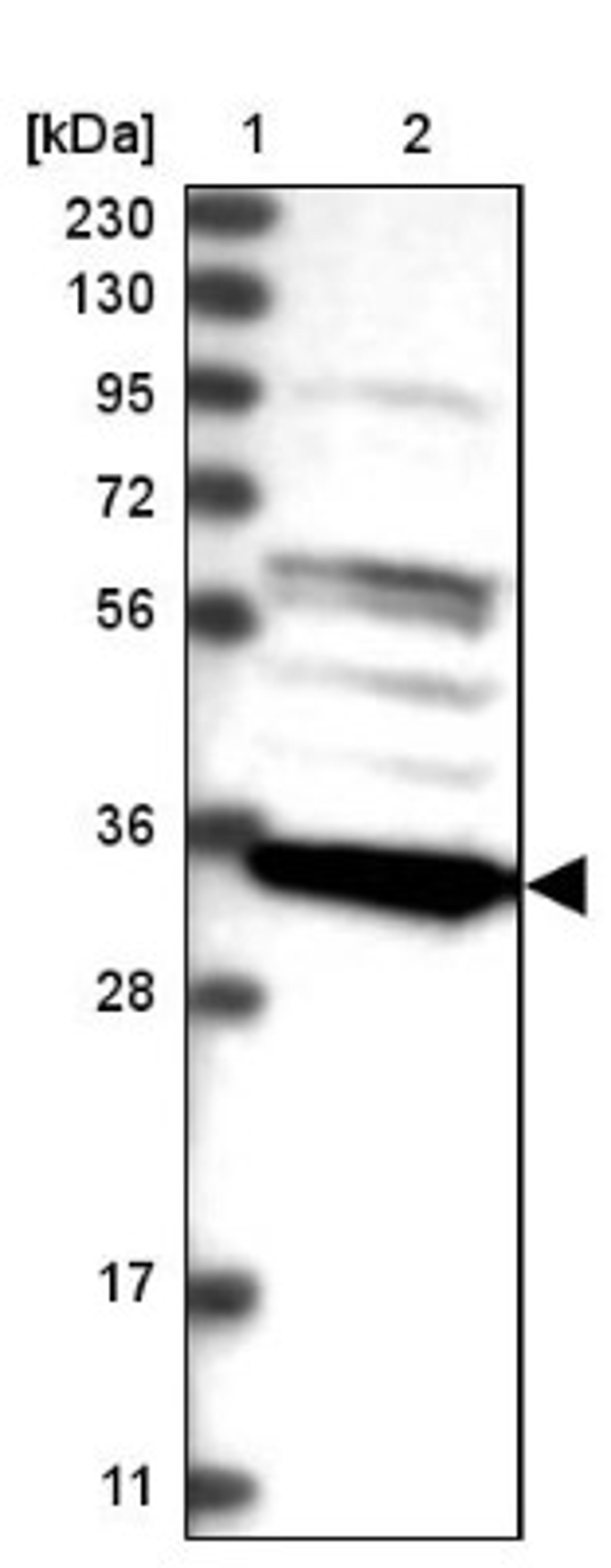 Western Blot: C8orf41/TTI2 Antibody [NBP1-82085] - Lane 1: Marker [kDa] 230, 130, 95, 72, 56, 36, 28, 17, 11<br/>Lane 2: Human cell line RT-4