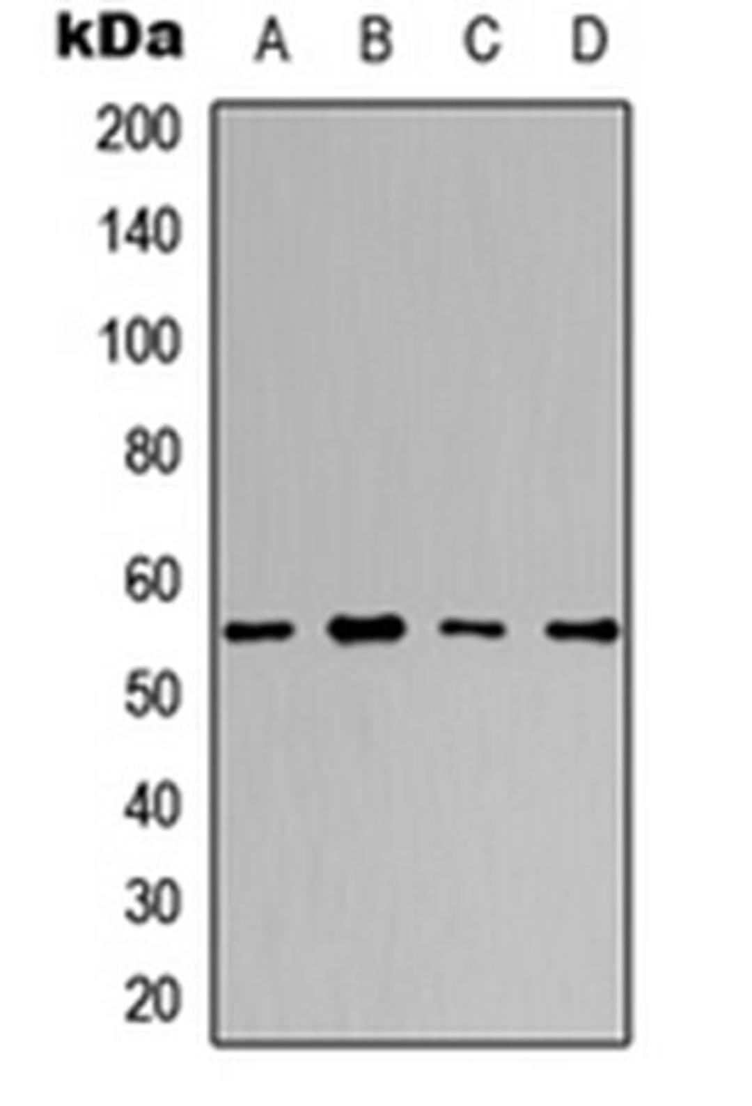 Western blot analysis of A549 (Lane 1), HeLa (Lane 2), NS-1 (Lane 3), H9C2 (Lane 4) whole cell lysates using DNA Polymerase gamma 2 antibody