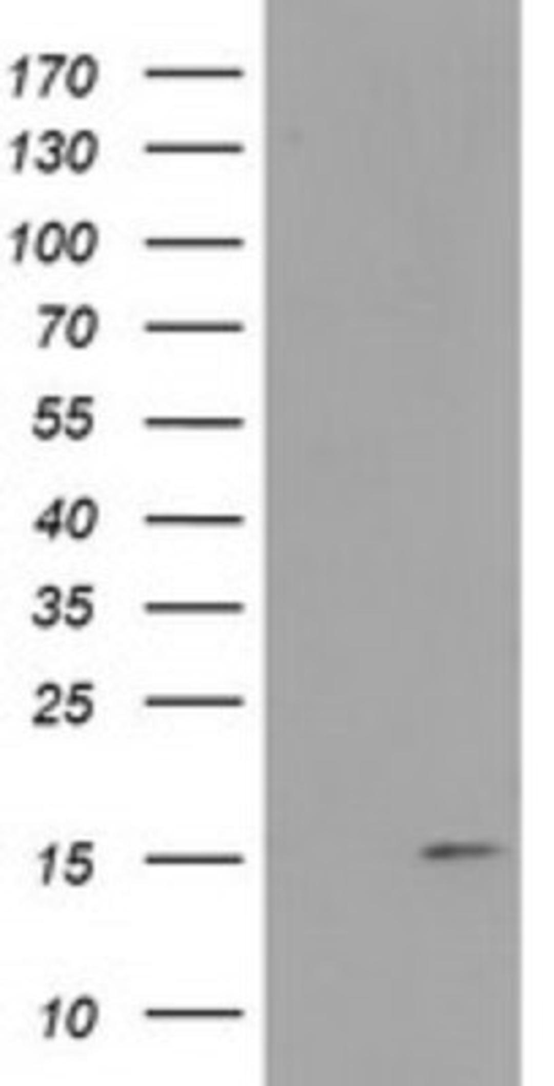 Western Blot: FAM127C Antibody (1A6) [NBP2-45699] - Analysis of HEK293T cells were transfected with the pCMV6-ENTRY control (Left lane) or pCMV6-ENTRY FAM127C.