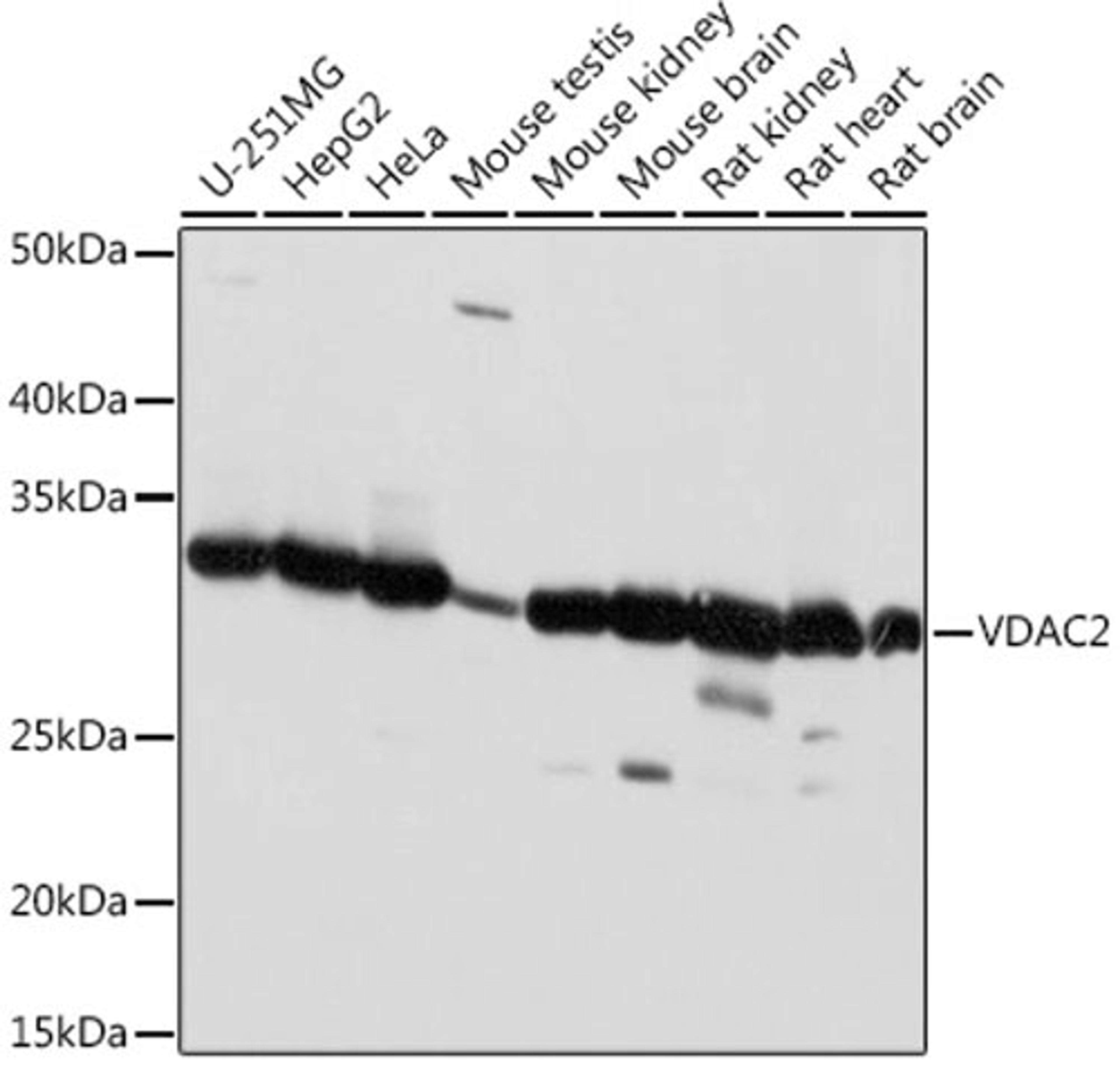 Western blot - VDAC2 antibody (A18683)