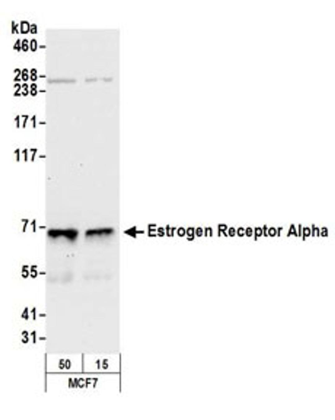 Detection of human Estrogen Receptor Alpha by western blot.