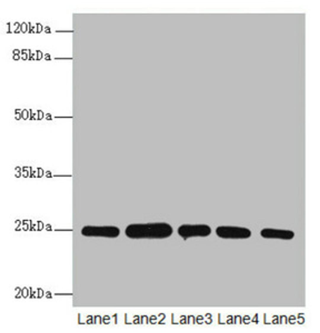 Western blot. All lanes: RAB5B antibody at 1.66ug/ml. Lane 1: A431 whole cell lysate. Lane 2: Hela whole cell lysate. Lane 3: Jurkat whole cell lysate. Lane 4: 293T whole cell lysate. Lane 5: HepG2 whole cell lysate. Secondary. Goat polyclonal to rabbit IgG at 1/10000 dilution. Predicted band size: 24, 20 kDa. Observed band size: 24, 31 kDa. 