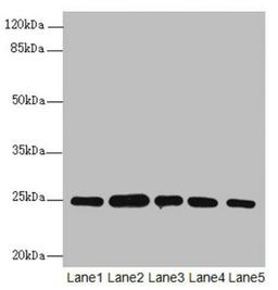 Western blot. All lanes: RAB5B antibody at 1.66ug/ml. Lane 1: A431 whole cell lysate. Lane 2: Hela whole cell lysate. Lane 3: Jurkat whole cell lysate. Lane 4: 293T whole cell lysate. Lane 5: HepG2 whole cell lysate. Secondary. Goat polyclonal to rabbit IgG at 1/10000 dilution. Predicted band size: 24, 20 kDa. Observed band size: 24, 31 kDa. 