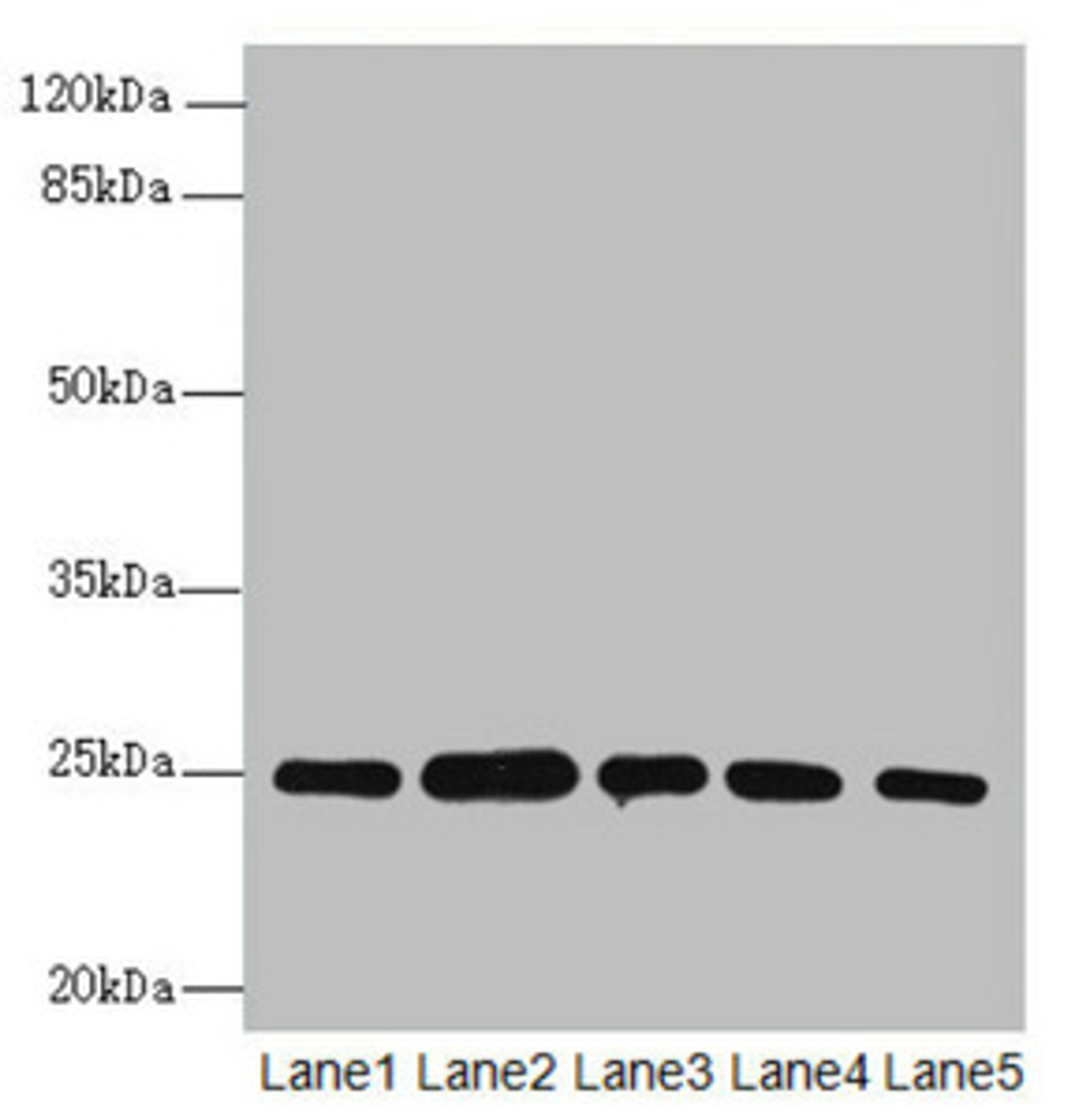 Western blot. All lanes: RAB5B antibody at 1.66ug/ml. Lane 1: A431 whole cell lysate. Lane 2: Hela whole cell lysate. Lane 3: Jurkat whole cell lysate. Lane 4: 293T whole cell lysate. Lane 5: HepG2 whole cell lysate. Secondary. Goat polyclonal to rabbit IgG at 1/10000 dilution. Predicted band size: 24, 20 kDa. Observed band size: 24, 31 kDa. 