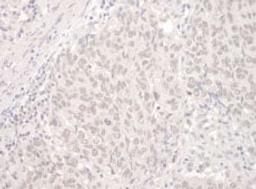 Detection of human PUF60 by immunohistochemistry.