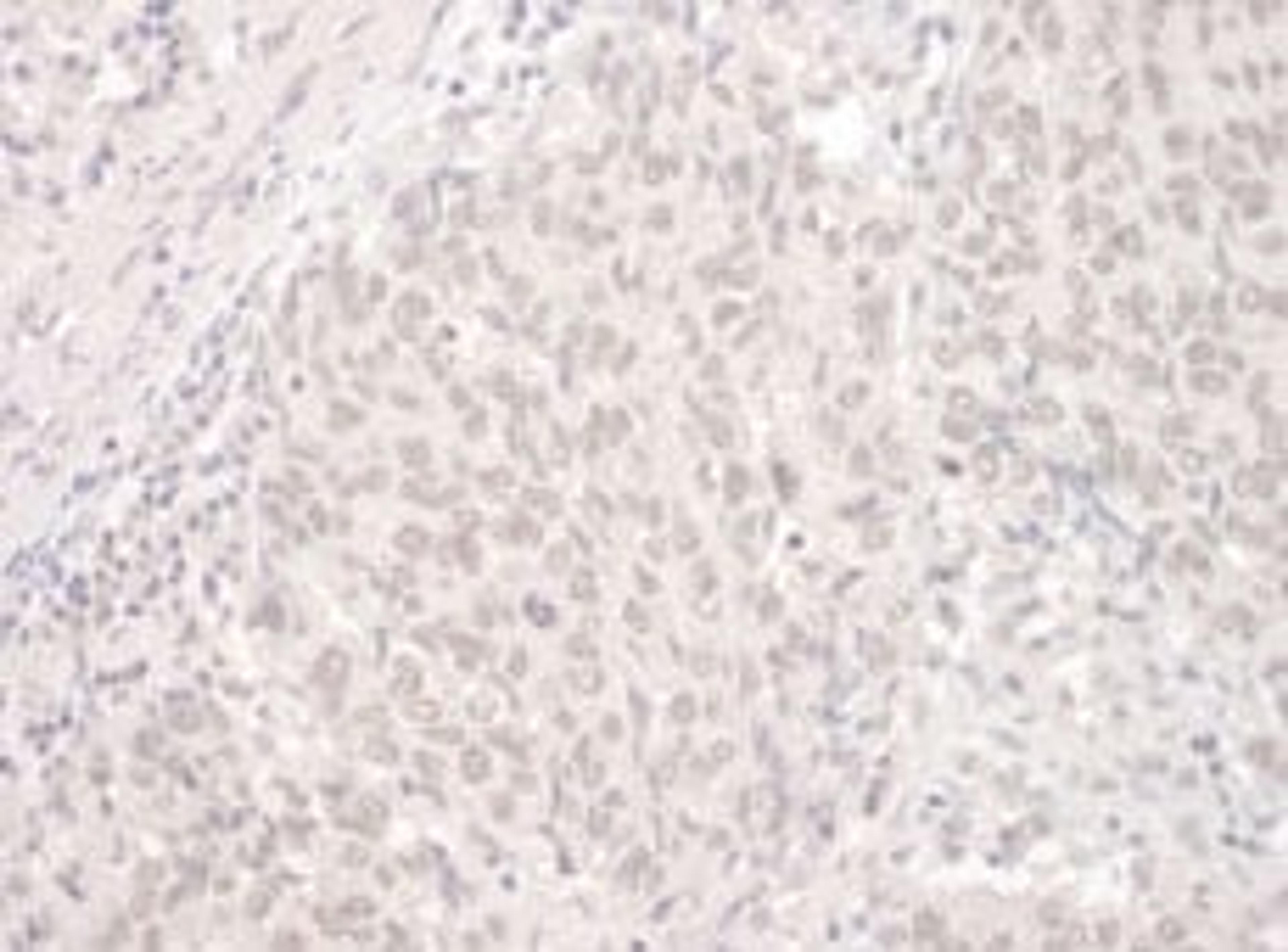 Detection of human PUF60 by immunohistochemistry.