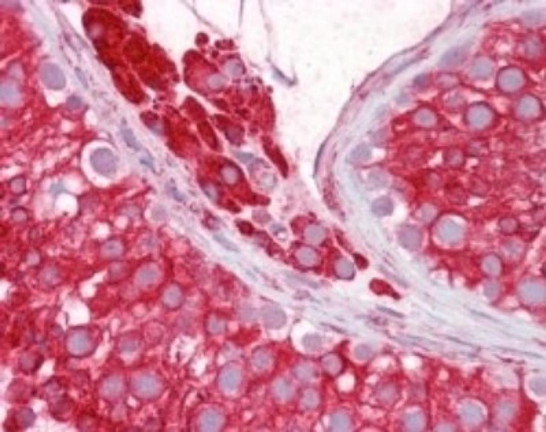 Immunohistochemistry-Paraffin: Nogo Antibody [NB100-56681] - analysis of human testis using Nogo antibody at 1:100.