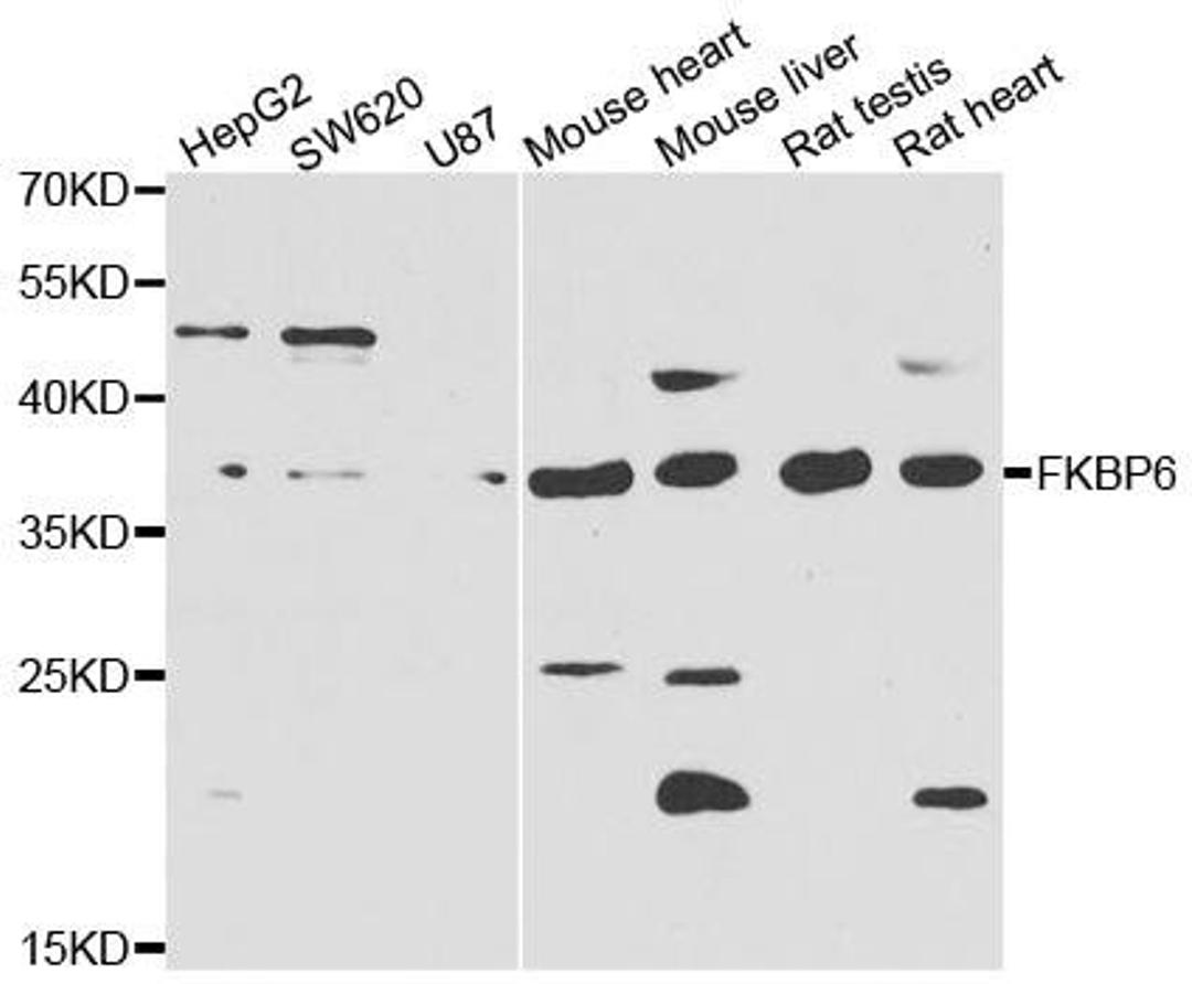 Western blot analysis of extracts of various cell lines using FKBP6 antibody