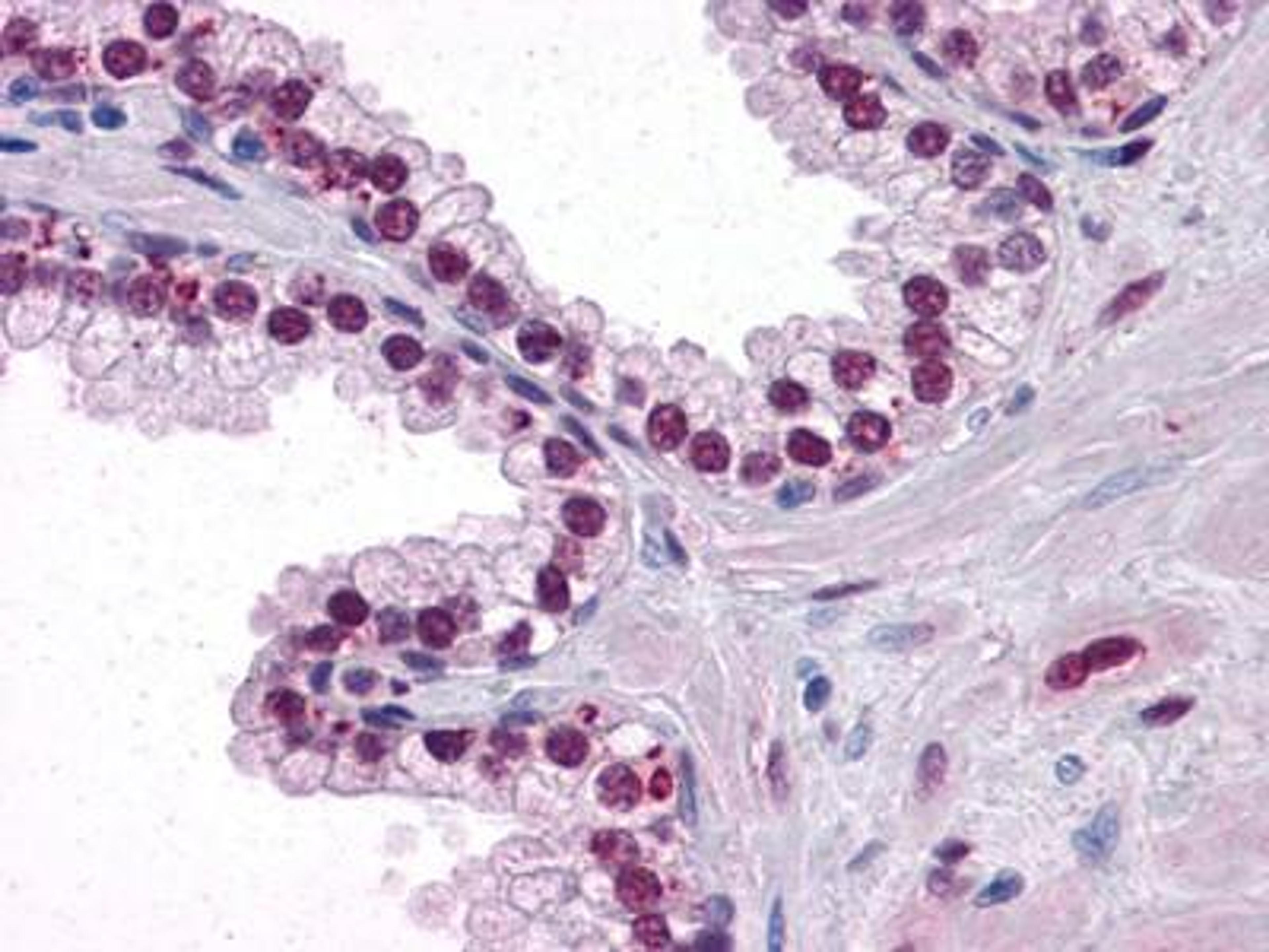 Immunohistochemistry-Paraffin: Androgen Receptor Antibody (2H8) [NBP1-47471] - Immunohistochemical analysis of paraffin-embedded human Prostate tissues using Androgen Receptor mouse mAb