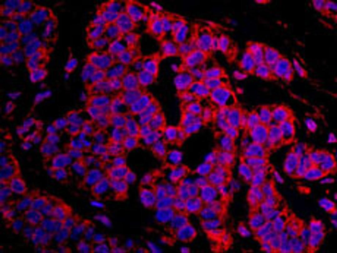 Detection of human CASC3 by immunohistochemistry.